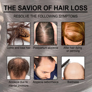 Rosemary Hair Care Essential Oil Anti-loss Hair Growth Hair Care Nourish Scalp Hair Roots